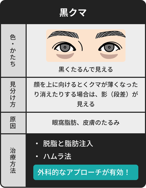 黒クマは黒くたるんで見えて顔を上に向けるとクマが薄くなったり消えたりする場合は影（段差）が見える、原因は眼窩脂肪や皮膚のたるみ、治療方法は脱脂と脂肪注入、ハムラ法、外科的なアプローチが有効