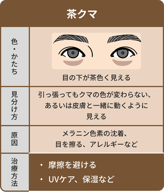 茶クマは目の下が茶色く見えて引っ張ってもクマの色が変わらない、あるいは皮膚と一緒に動くように見える、原因はメラニン色素の沈着や目を擦ること、アレルギーなど。治療方法は摩擦を避けることやUVケア、保湿など。