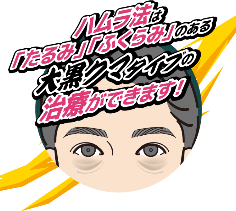 ハムラ法は「たるみ」「ふくらみ」のある大黒クマタイプの治療ができます