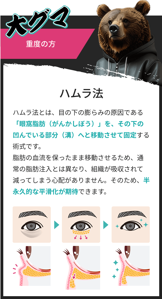 大熊重度の方はハムラ法