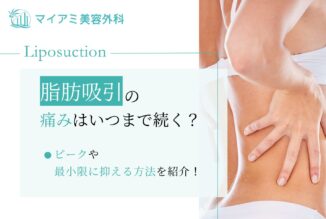 脂肪吸引の痛みはいつまで続く？ピークや最小限に抑える方法を紹介！