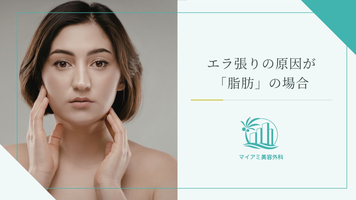 エラ張りの原因が「脂肪」の場合
