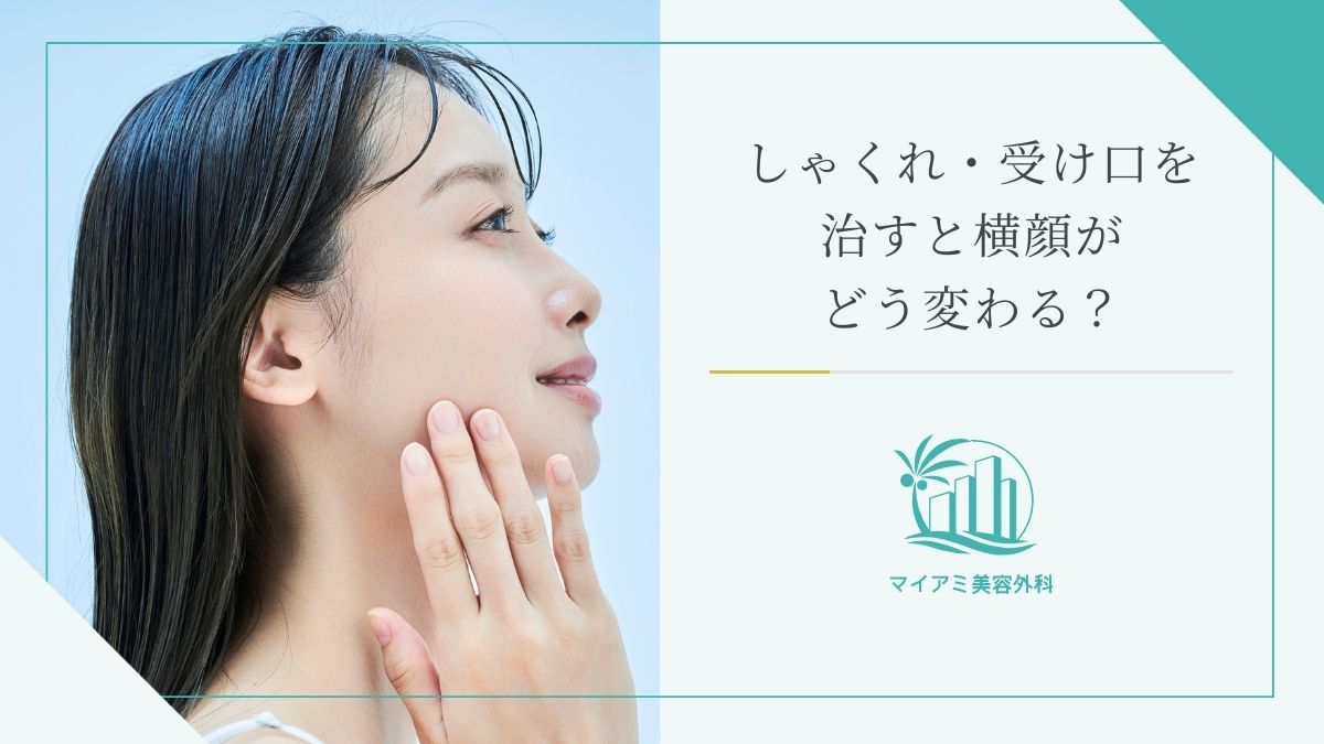 しゃくれ・受け口を治すと横顔がどう変わるか?