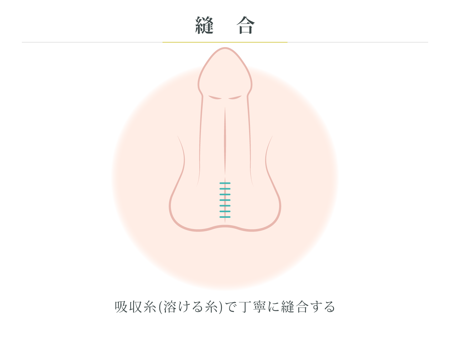 illustration_縫合