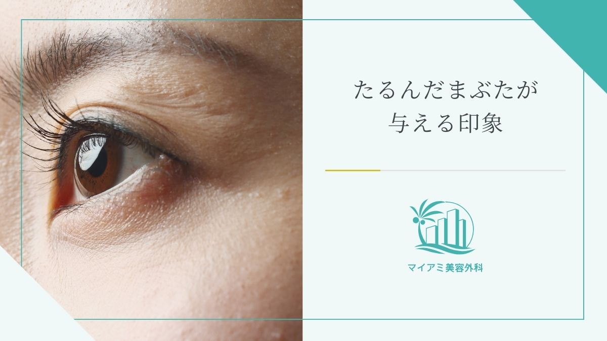 たるんだまぶたが与える印象