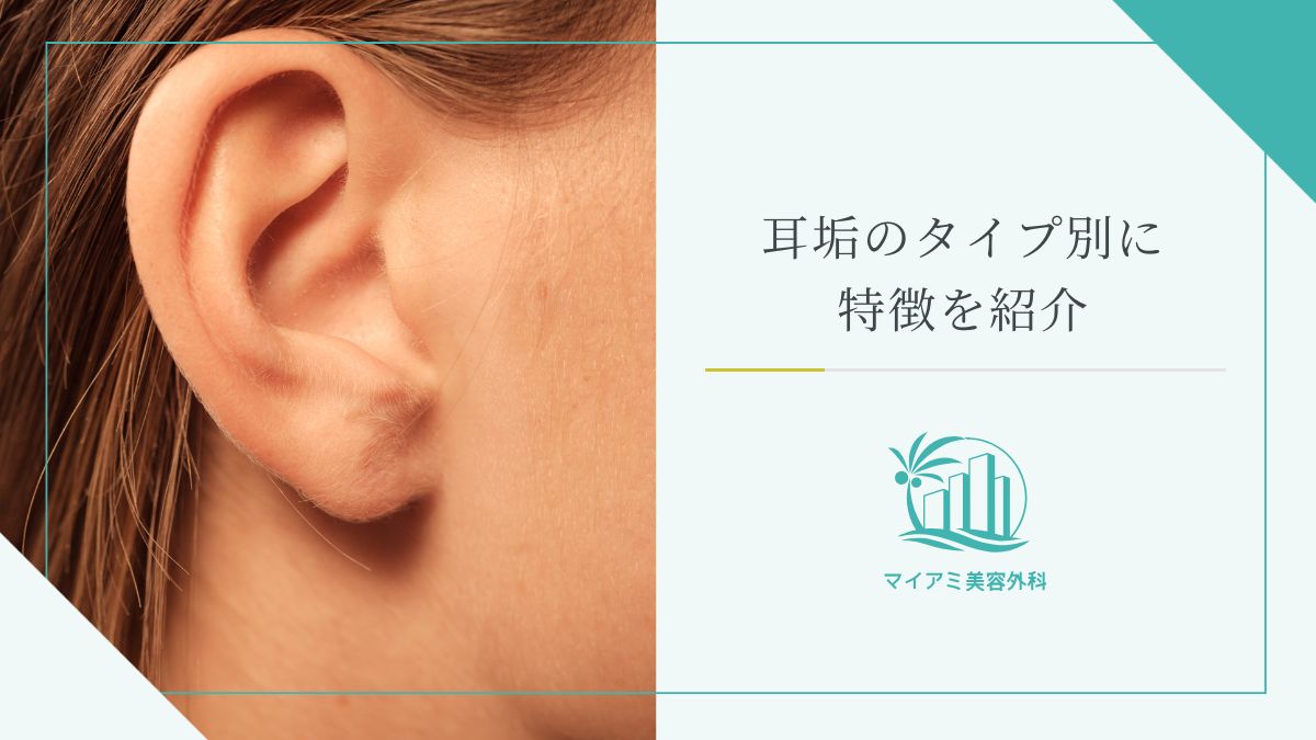 耳垢のタイプ別に特徴を紹介
