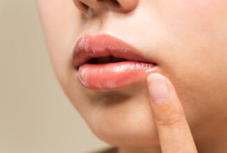 たらこ唇の治し方やコンプレックス解消方法を詳しく解説