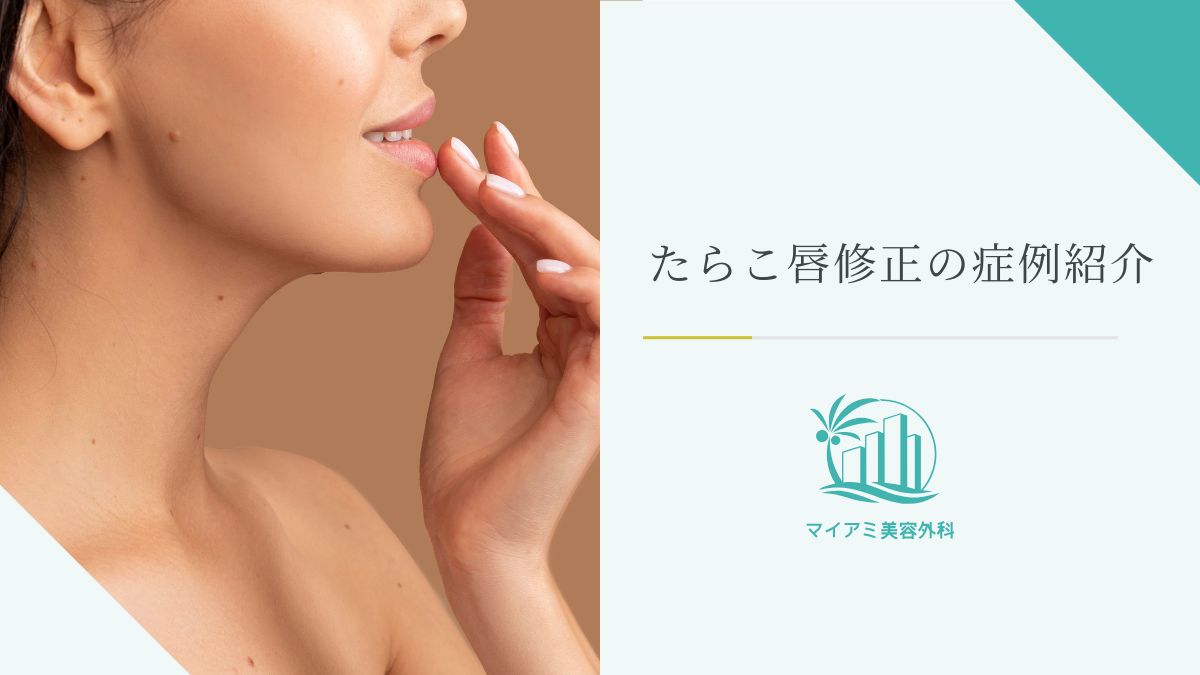 たらこ唇修正の症例紹介