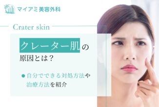 クレーター肌の原因とは？自分でできる対処方法や治療方法を紹介