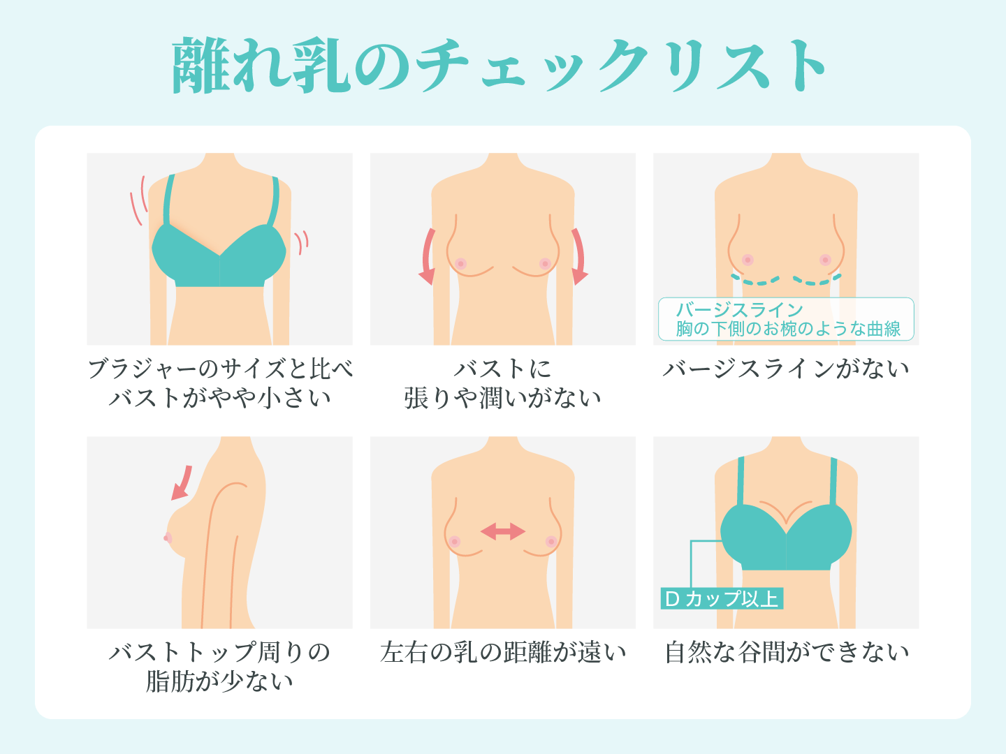 離れ乳のチェックリスト