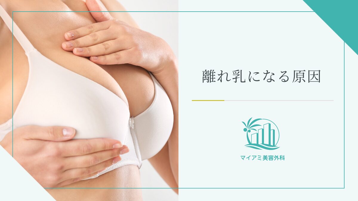 離れ乳になる原因