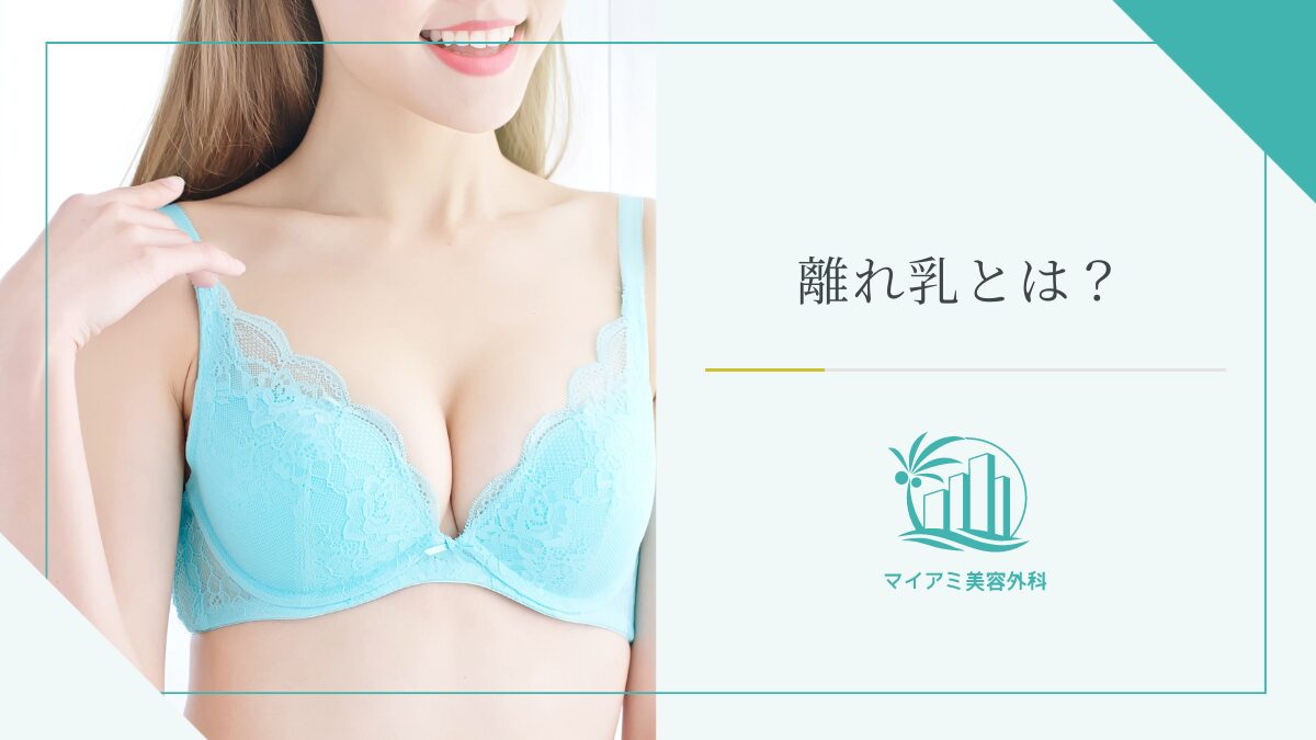 離れ乳とは？