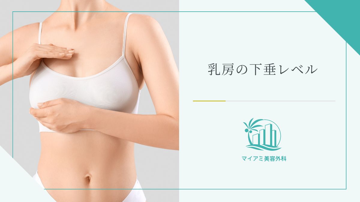 乳房の下垂レベル