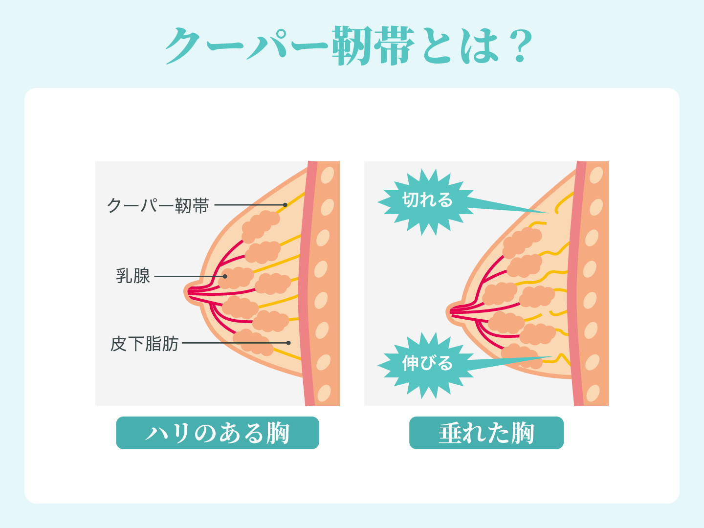 クーパー靭帯とは？