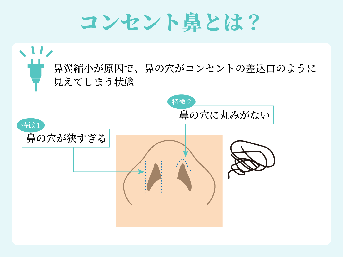 コンセント鼻とは？