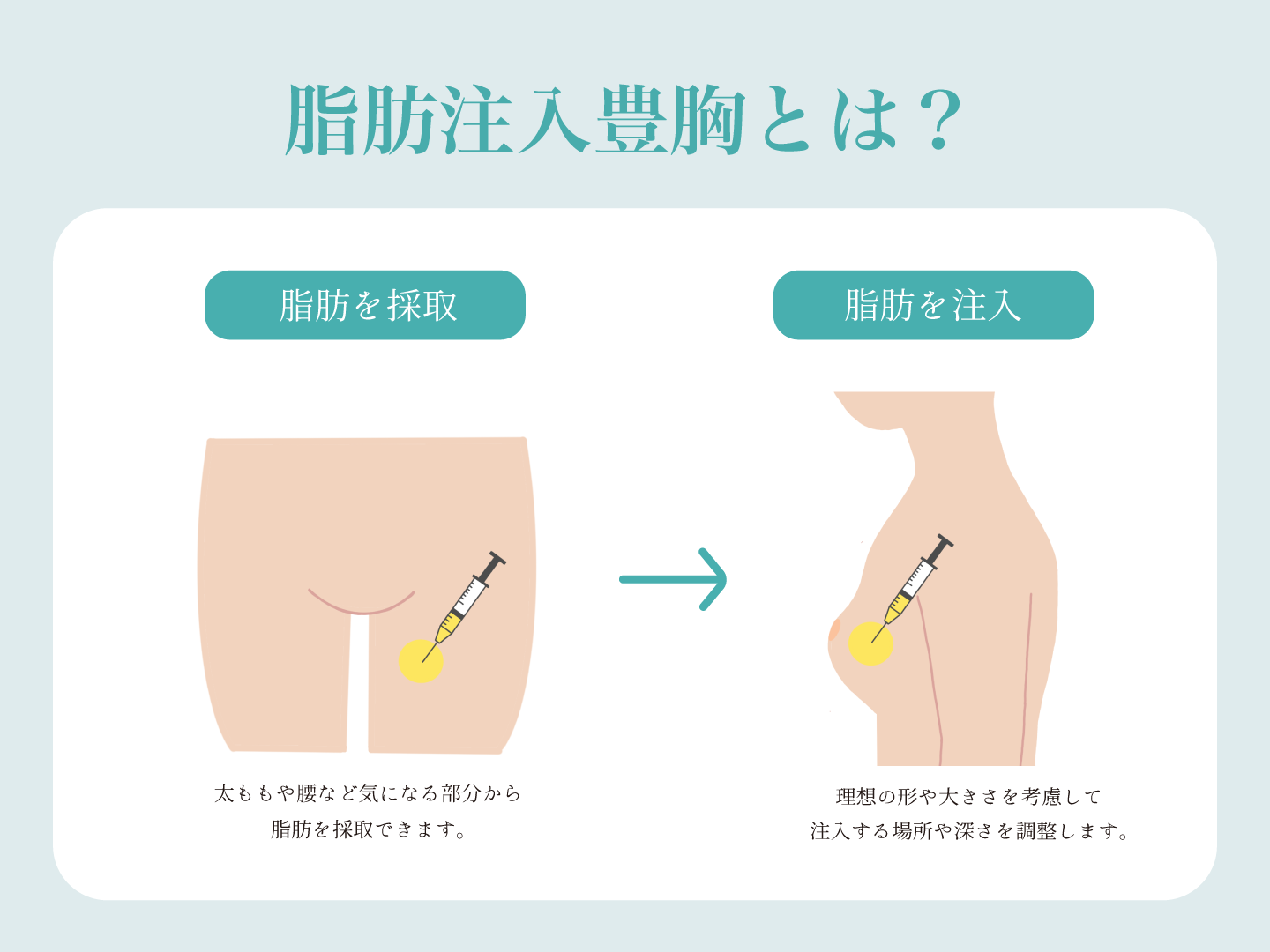 胸を大きくする方法7選！自己ケアとトレーニングで理想のバストに | 銀座マイアミ美容外科