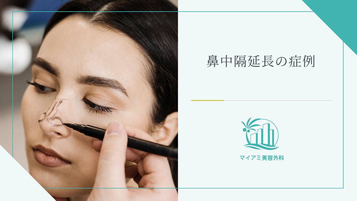 鼻中隔延長の症例