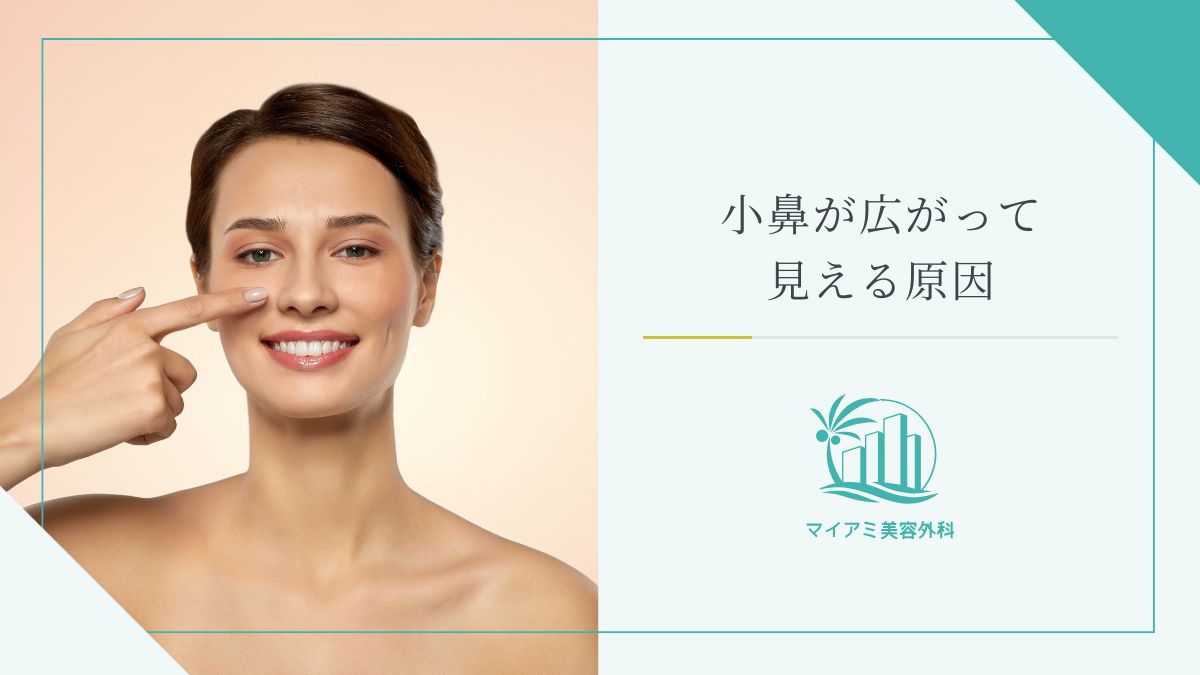 小鼻が広がって見える原因