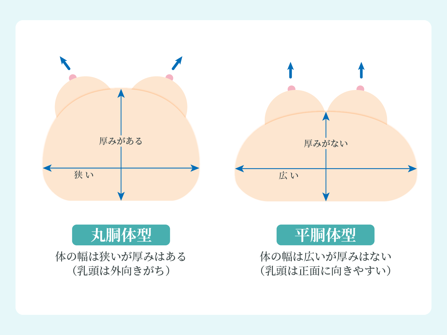 平胴体型