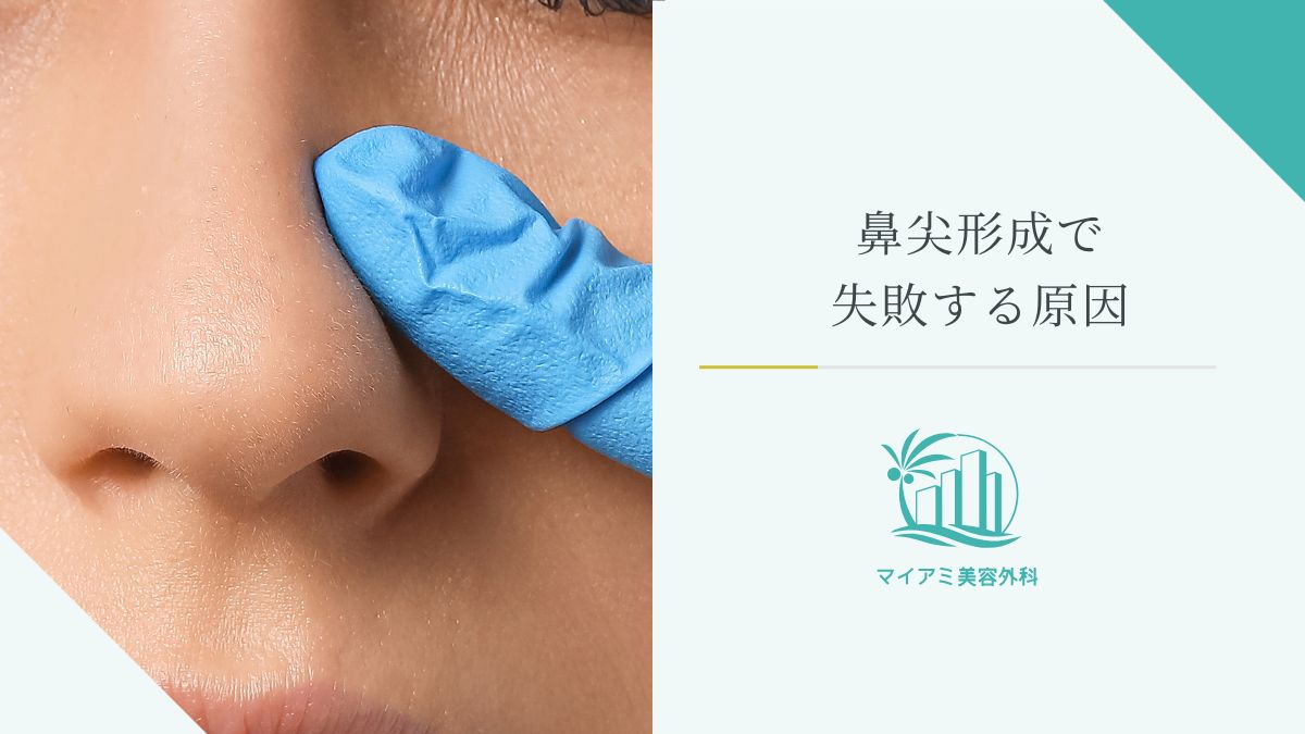 鼻尖形成で失敗する原因