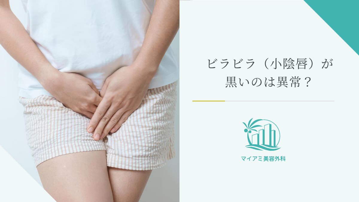 ビラビラ（小陰唇）が黒いのは異常？