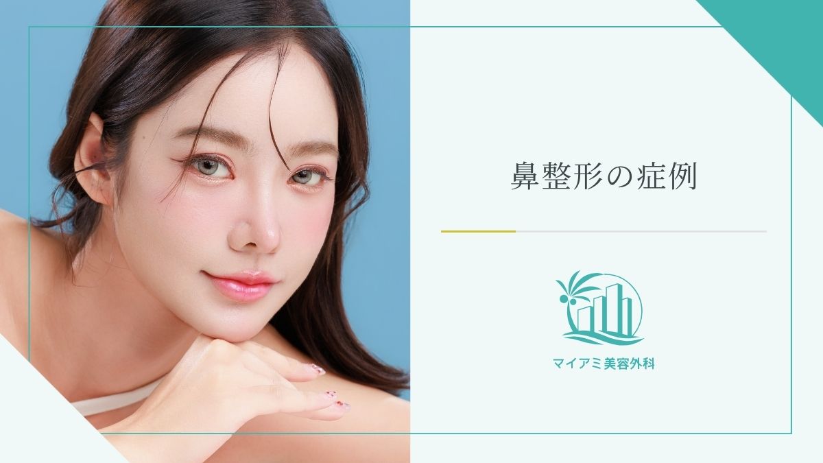 鼻整形の症例