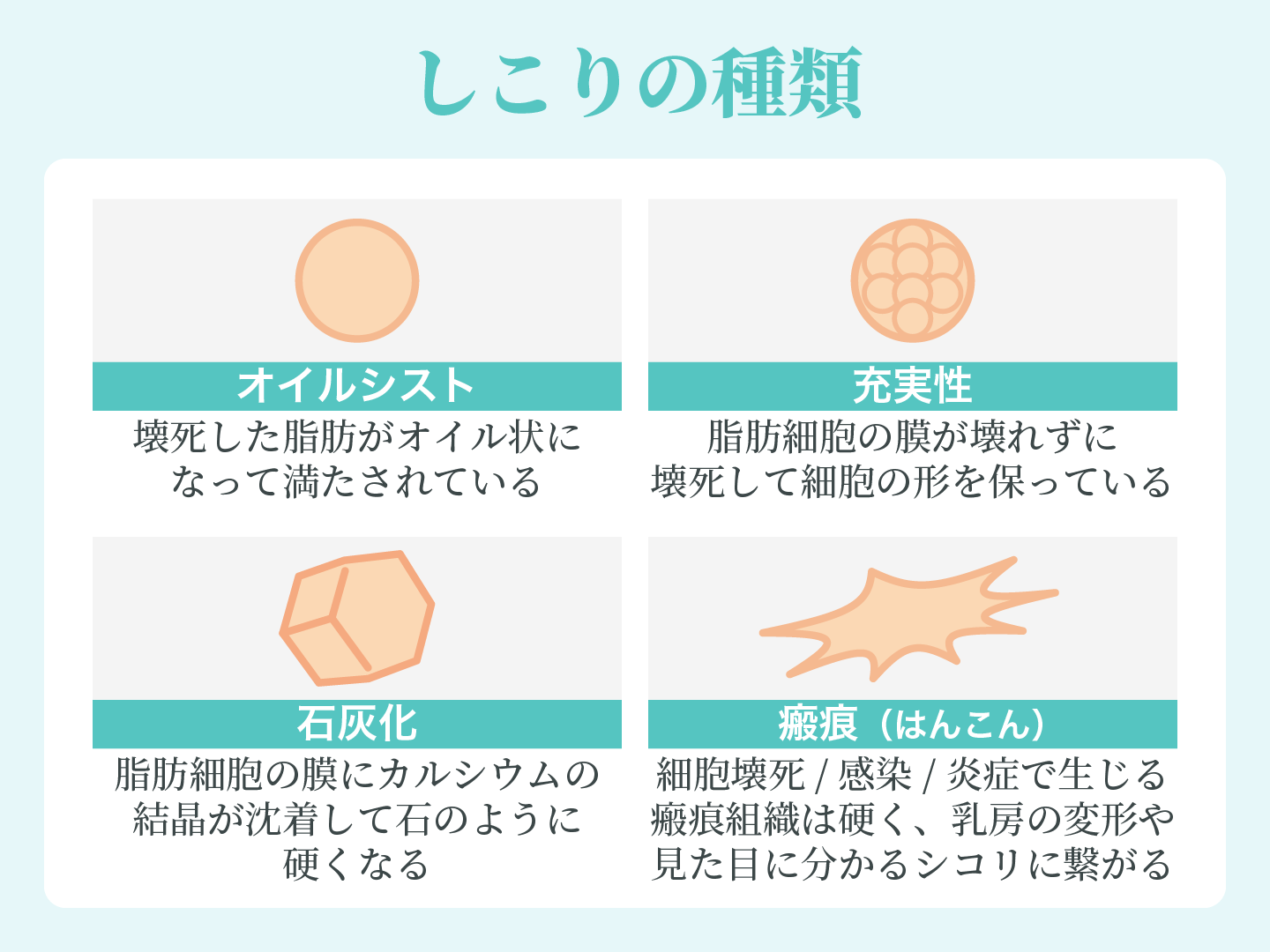 しこりの種類