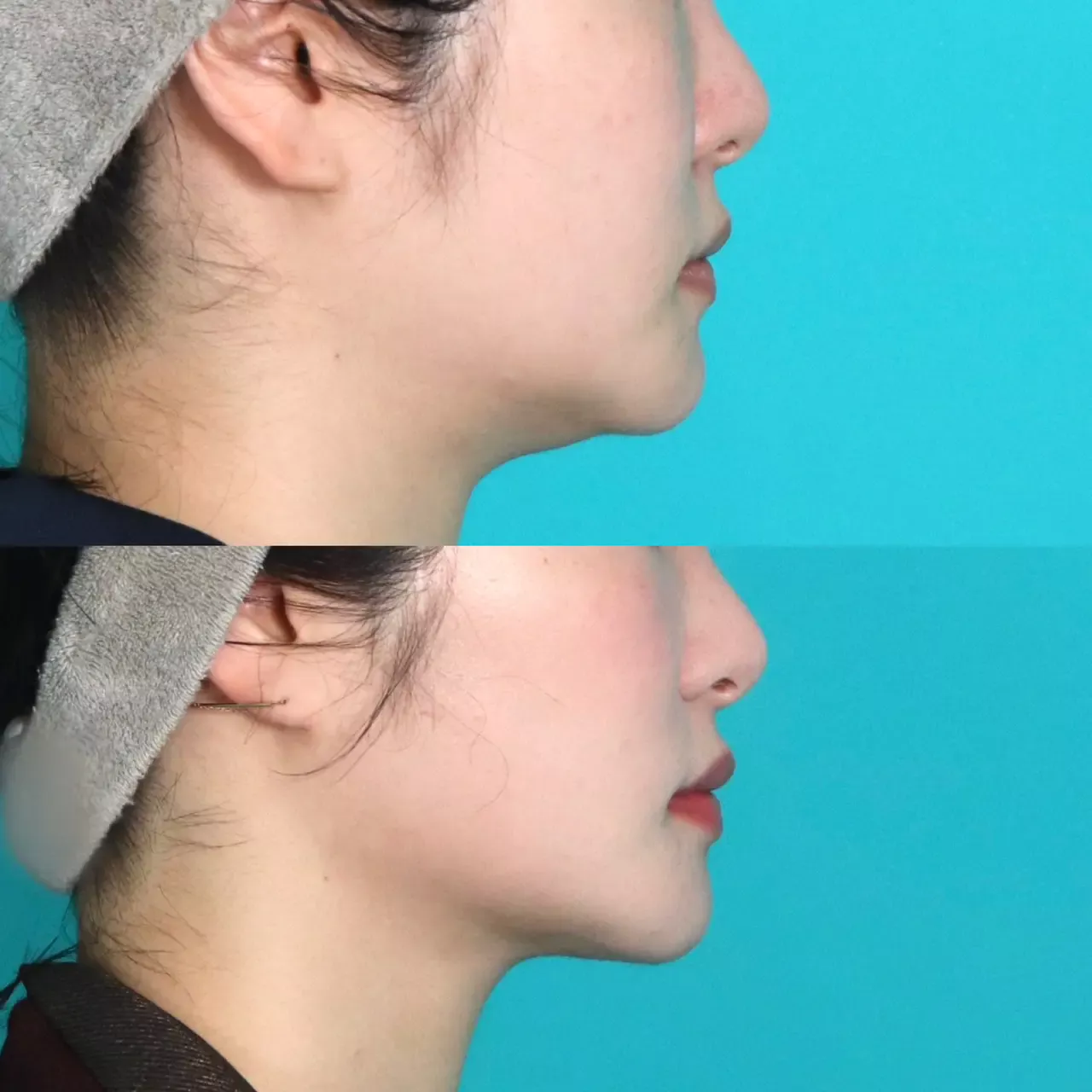 施術前後イメージ