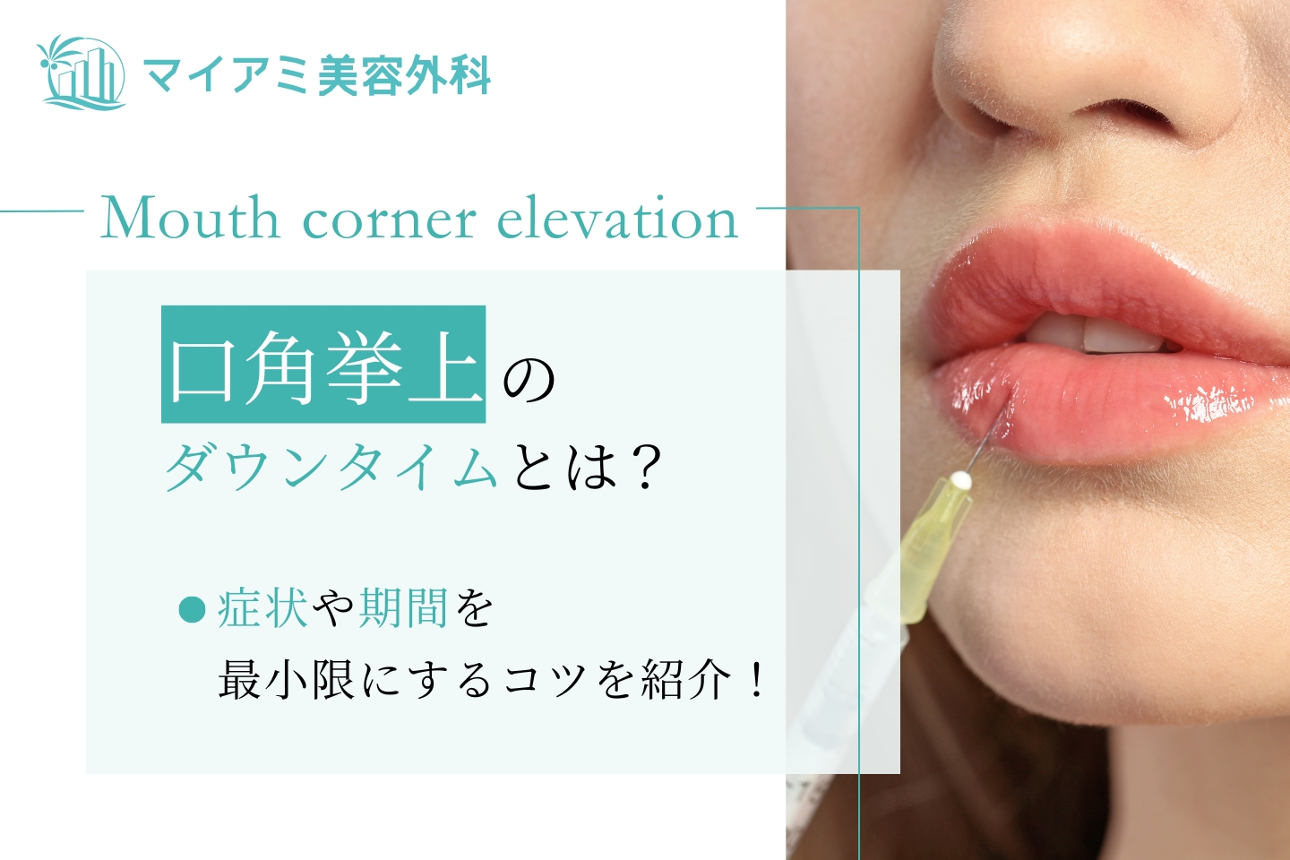 口角挙上 ダウンタイム