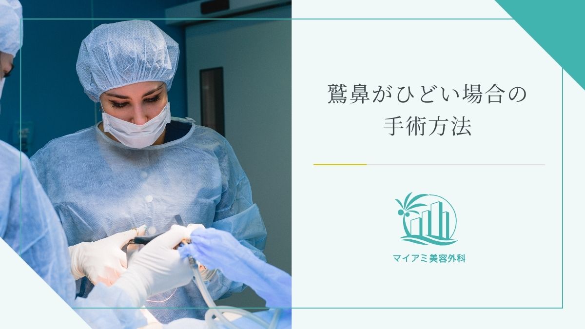 鷲鼻がひどい場合の手術方法