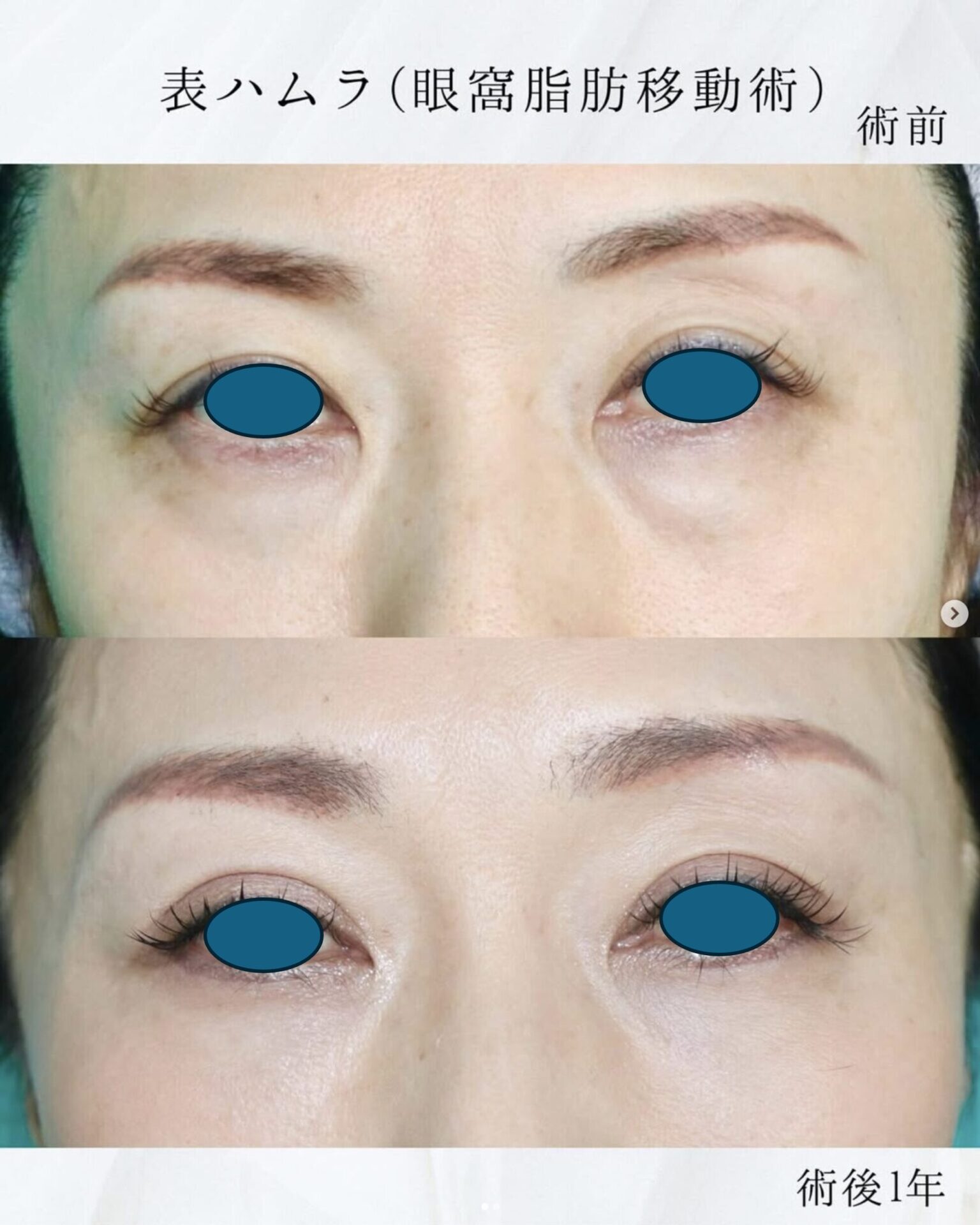 施術前後イメージ