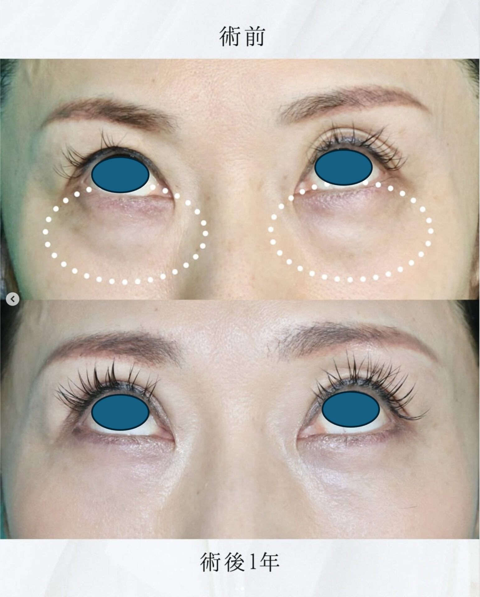 施術前後イメージ