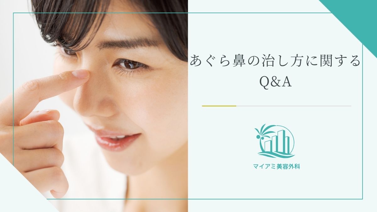 あぐら鼻の治し方に関するQ&A
