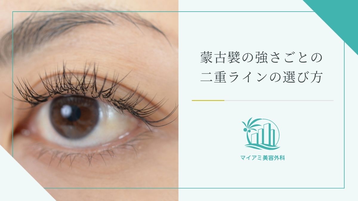 蒙古襞の強さごとの二重ラインの選び方