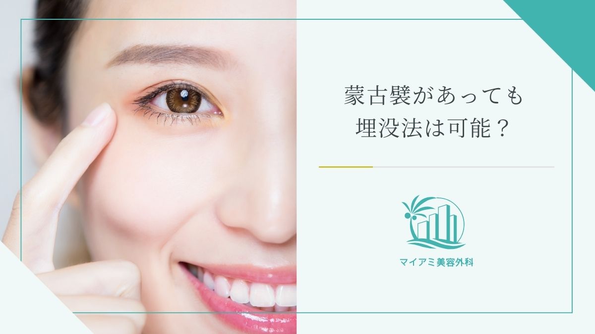 蒙古襞があっても埋没法は可能？