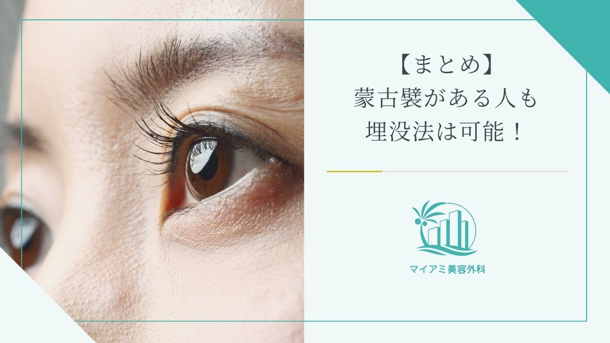 【まとめ】蒙古襞がある人も埋没法は可能！