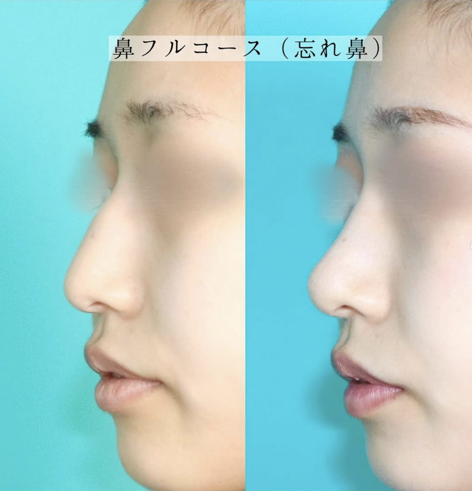 施術前後イメージ