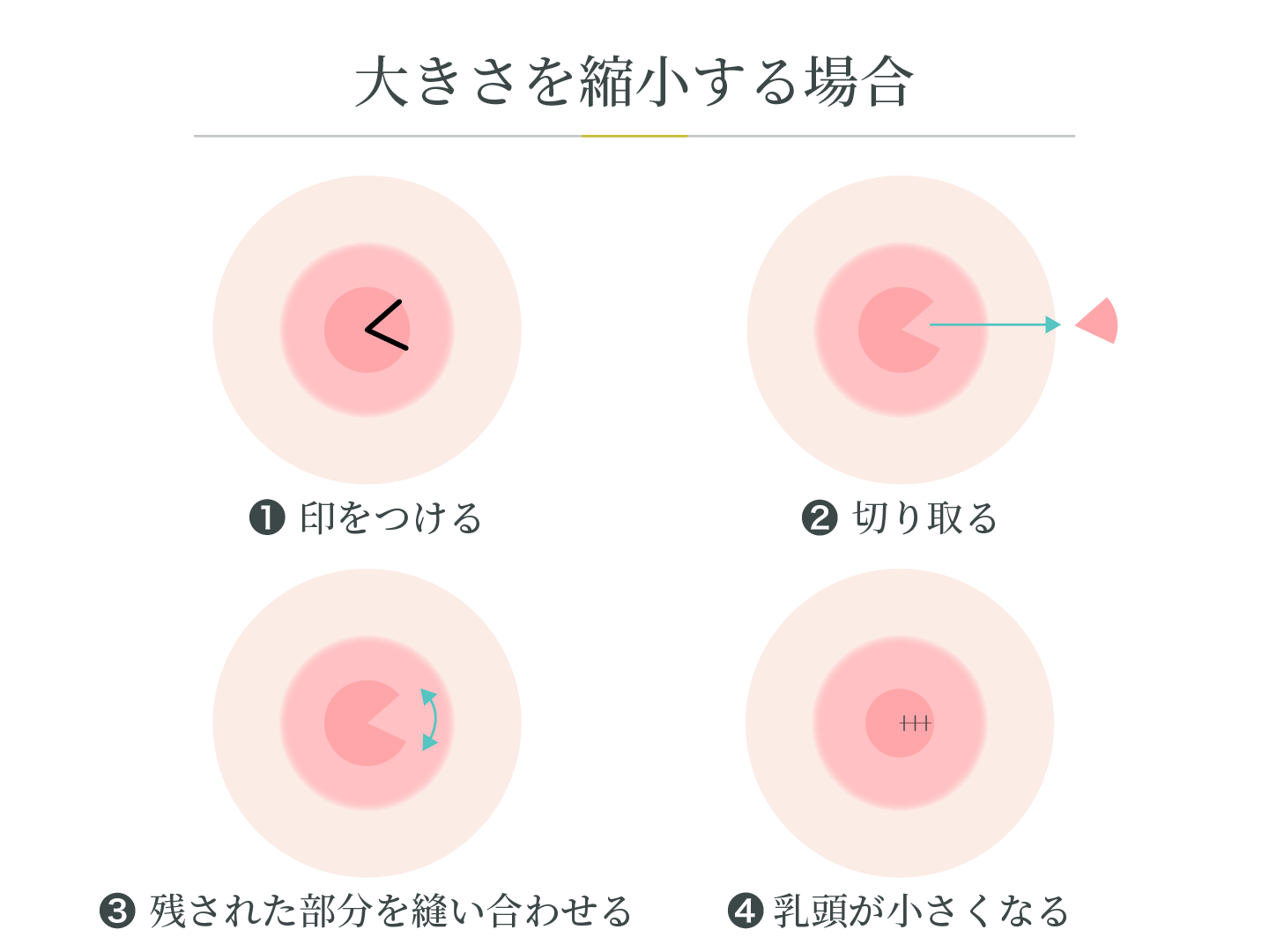 illustration_乳頭縮小_大きさの縮小