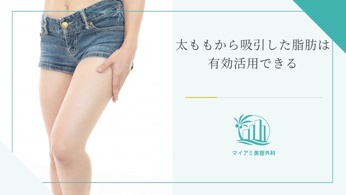 太ももから吸引した脂肪は有効活用できる