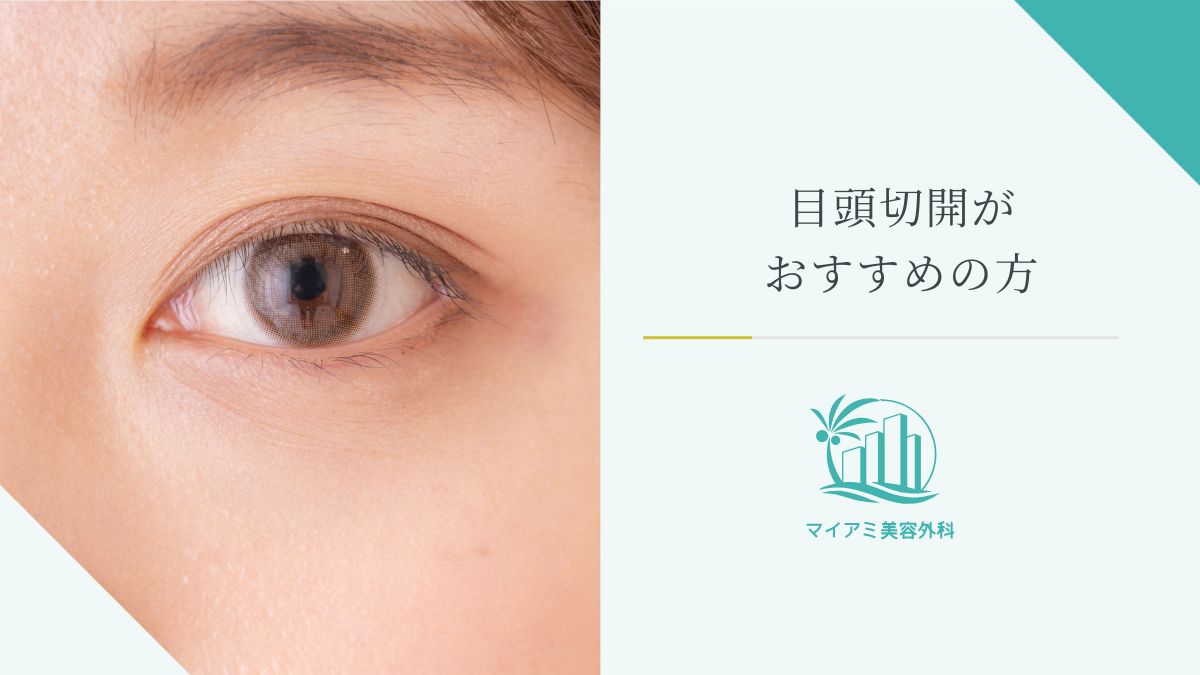 目頭切開がおすすめの方