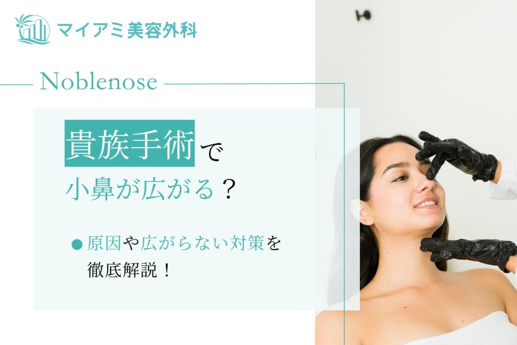 貴族手術 小鼻広がる