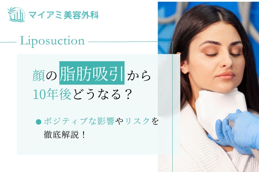 顔 脂肪吸引 10年後