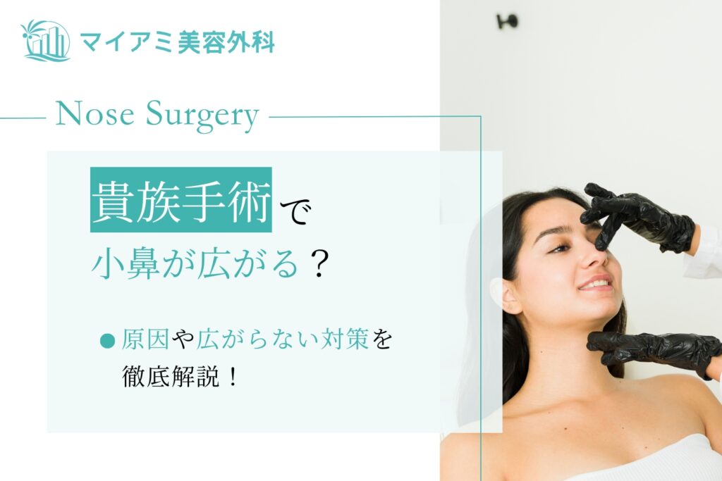 貴族手術 小鼻広がる