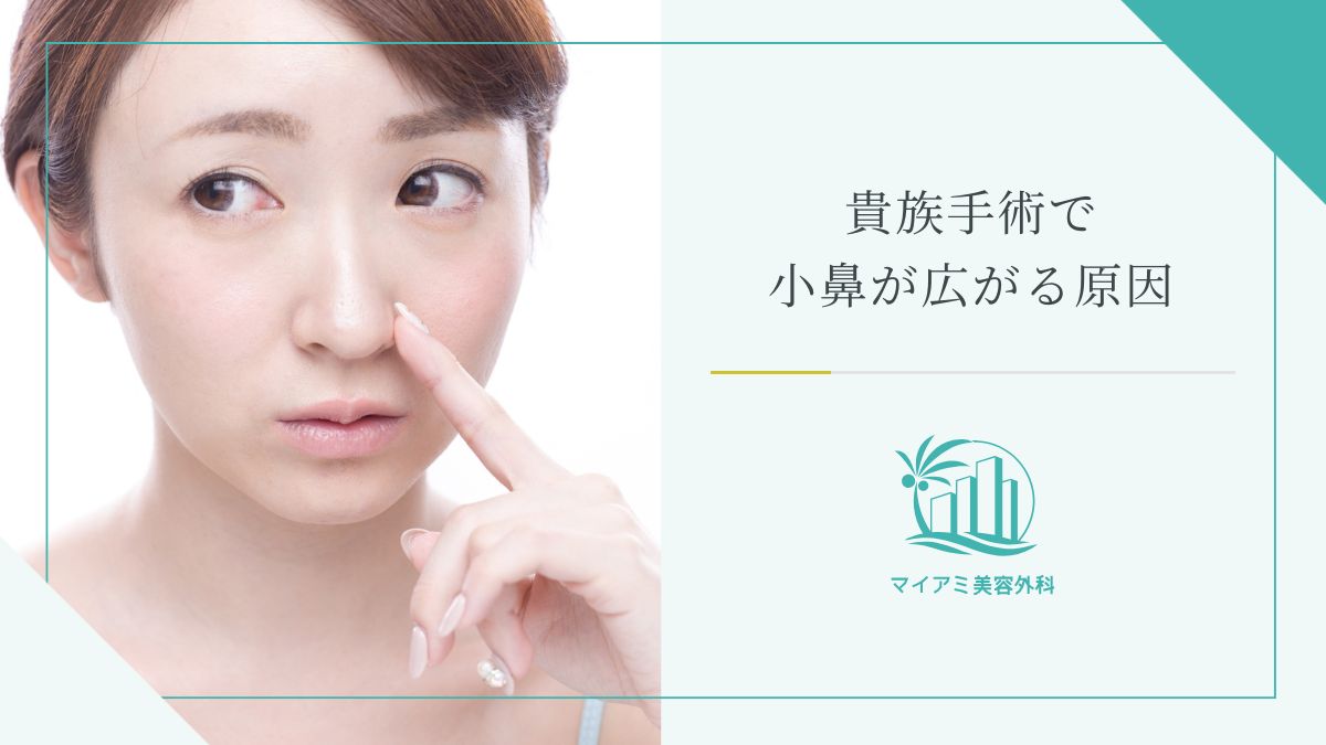 貴族手術で小鼻が広がる原因