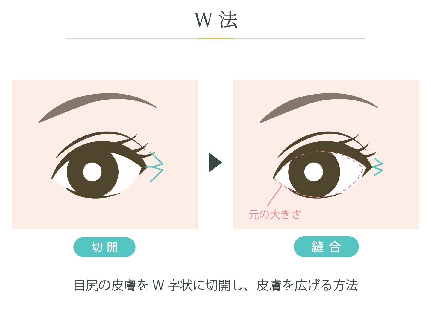 illustration_目尻_W法