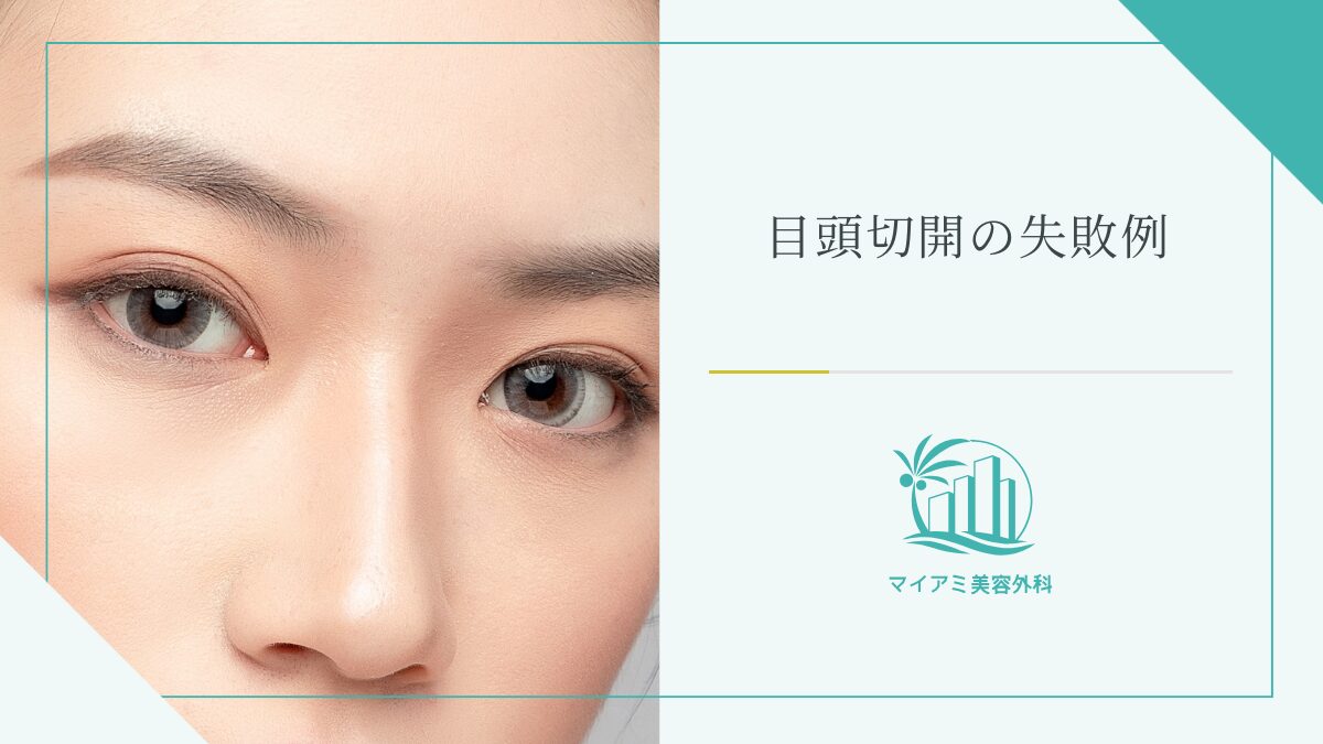 目頭切開の失敗例