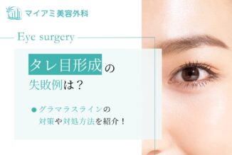 タレ目形成（グラマラスライン）の失敗例は？対策や対処方法を紹介！