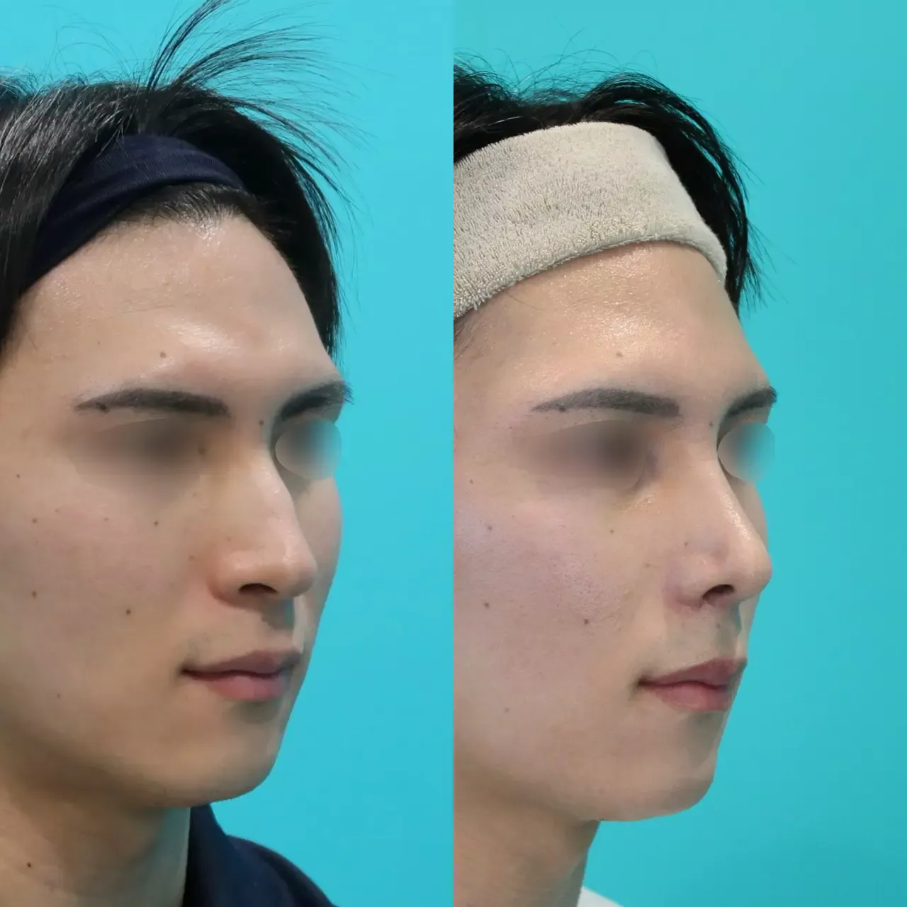 施術前後イメージ