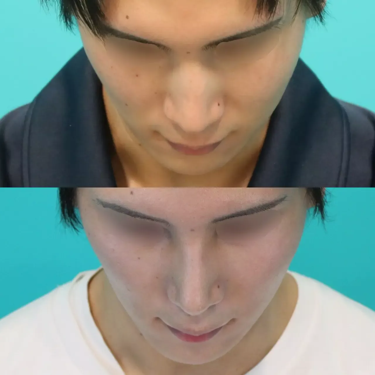 施術前後イメージ