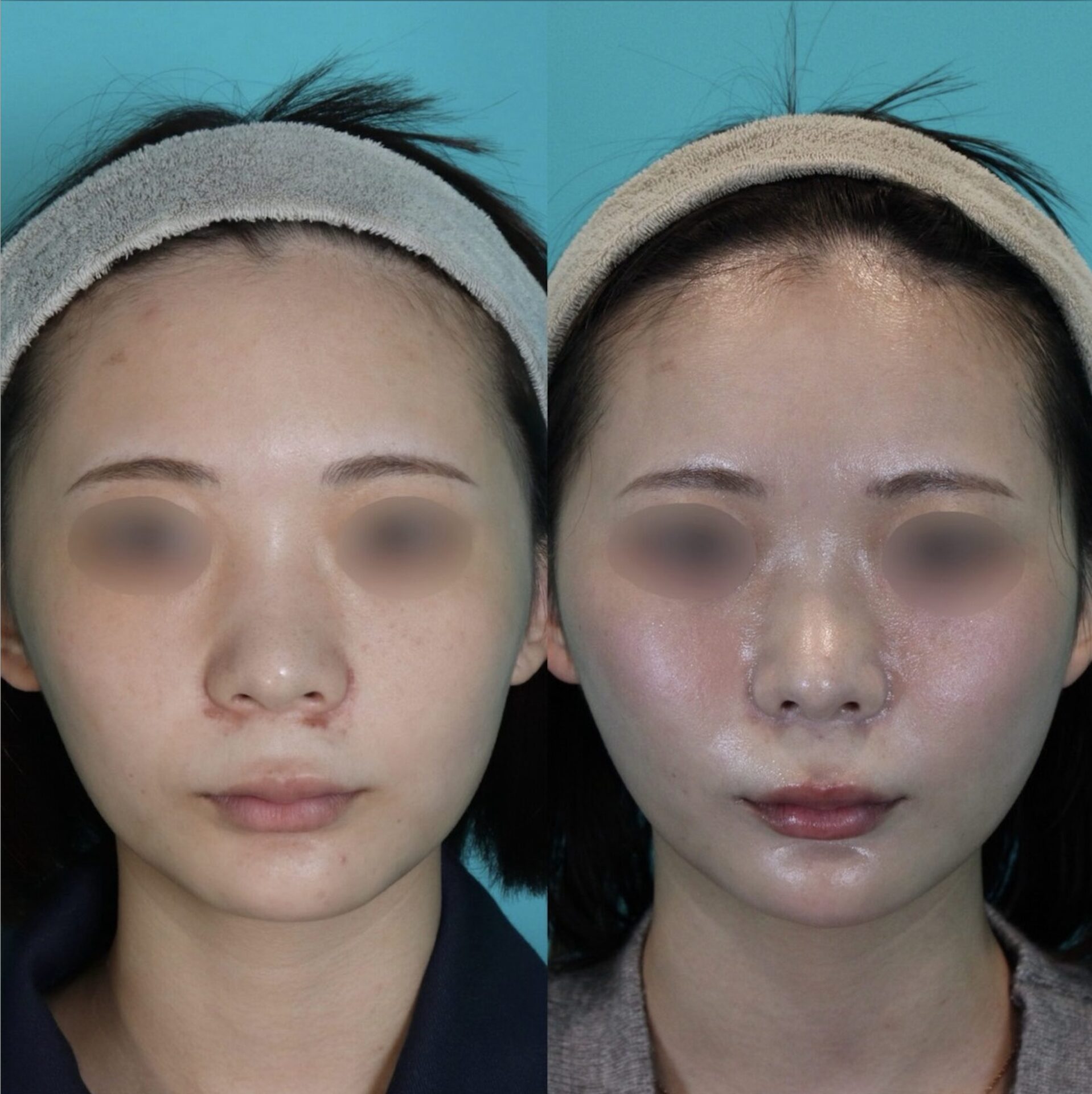 施術前後イメージ